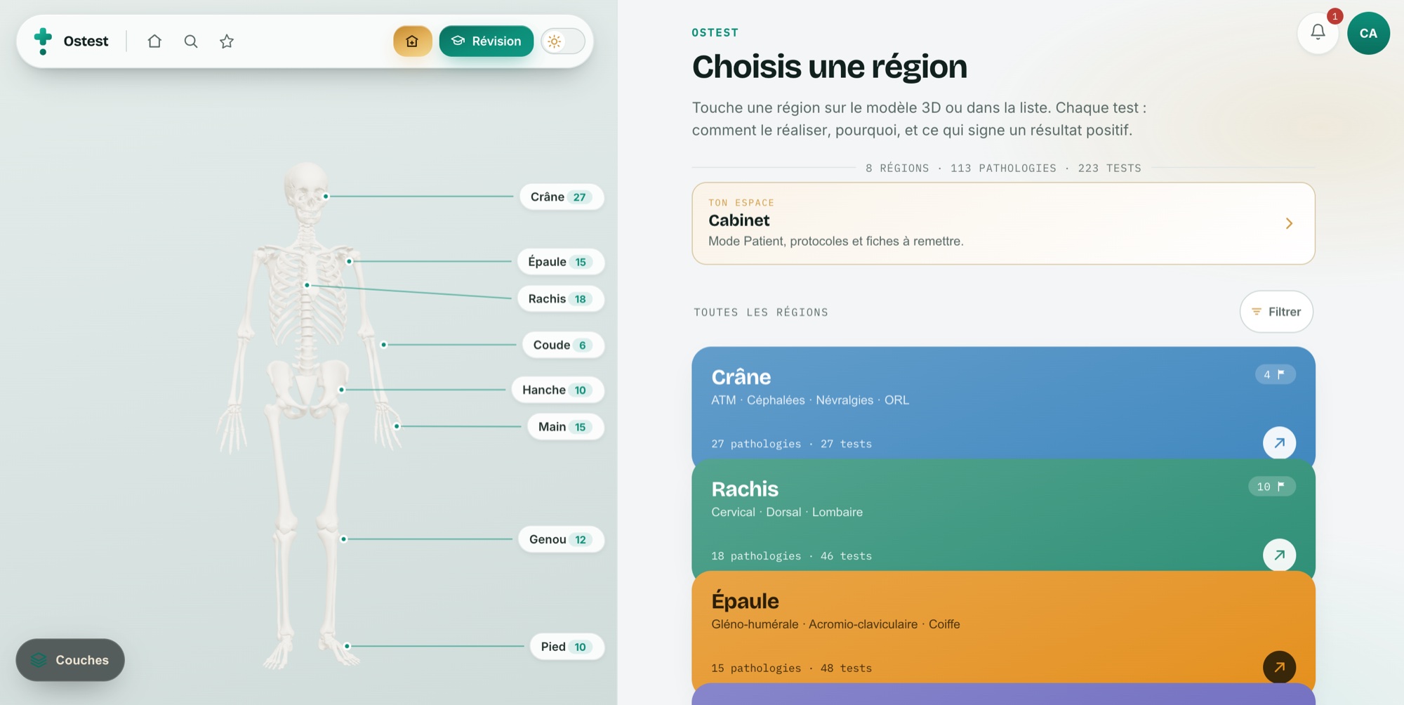 L'application Ostest : le modèle 3D à gauche avec les régions annotées, la liste des régions à droite.